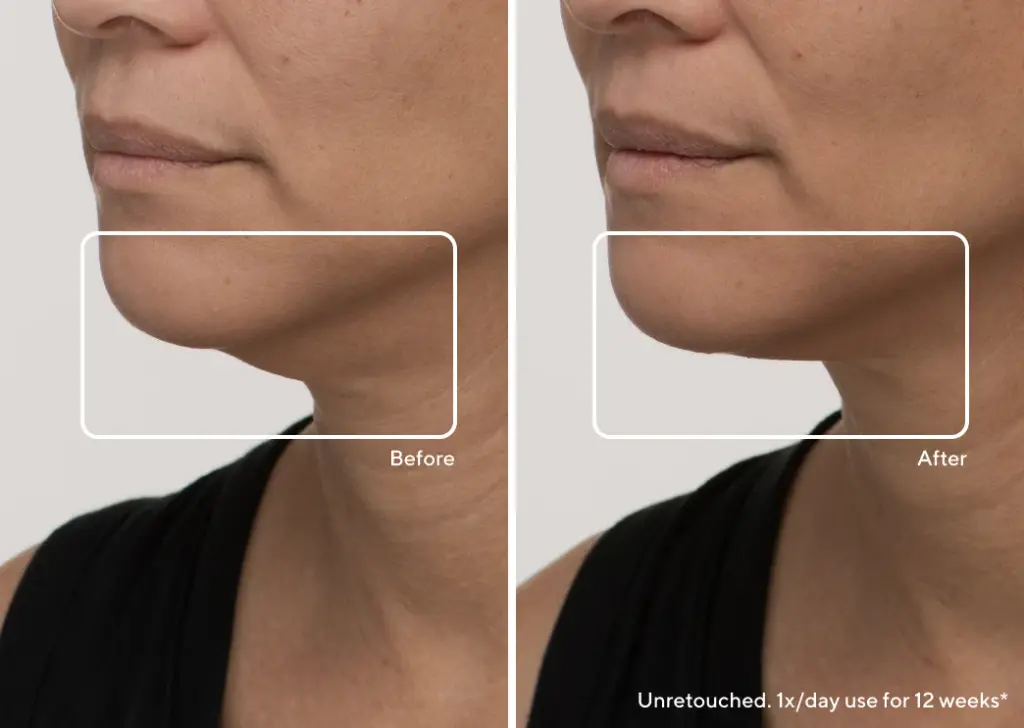 Real-Results-Image face mask mourixa Qatar.webp