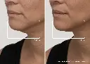 Real-Results-Image face mask mourixa Qatar.webp
